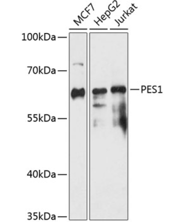 PES1 Rabbit Polyclonal Antibody