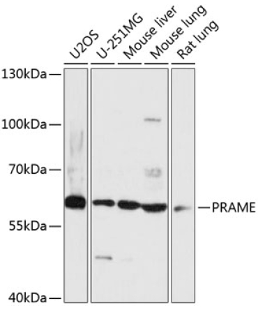 PRAME Rabbit Polyclonal Antibody
