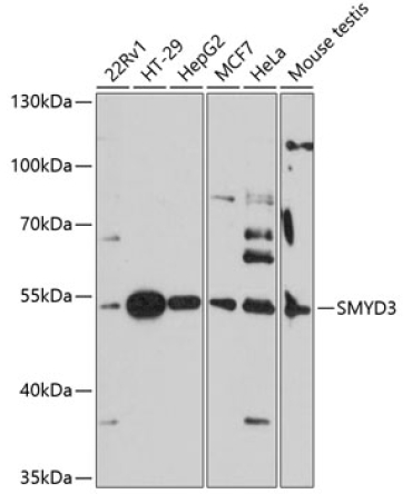 SMYD3 Rabbit Polyclonal Antibody