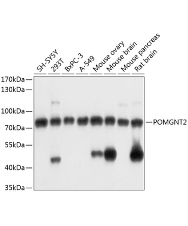 POMGNT2 Rabbit Polyclonal Antibody