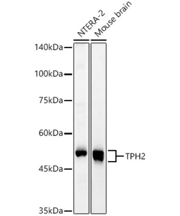TPH2 Rabbit Polyclonal Antibody
