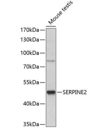 SERPINE2 Rabbit Polyclonal Antibody