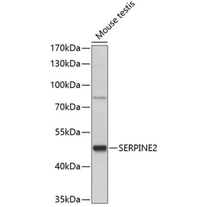 SERPINE2 Rabbit Polyclonal Antibody