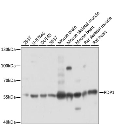 PDP1 Rabbit Polyclonal Antibody
