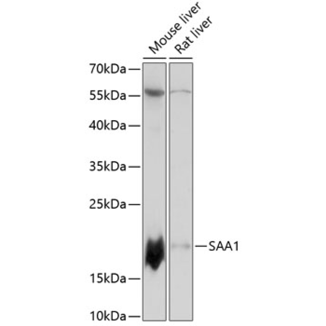 SAA1 Rabbit Polyclonal Antibody