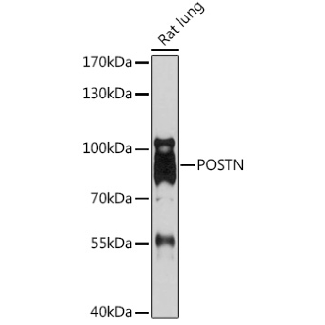 POSTN Rabbit Polyclonal Antibody