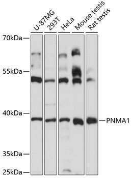 PNMA1 Rabbit Polyclonal Antibody