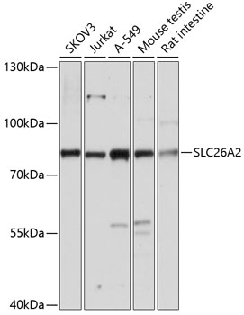 SLC26A2 Rabbit Polyclonal Antibody