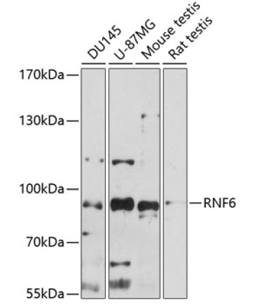 RNF6 Rabbit Polyclonal Antibody