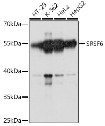 SRSF6 Rabbit Polyclonal Antibody