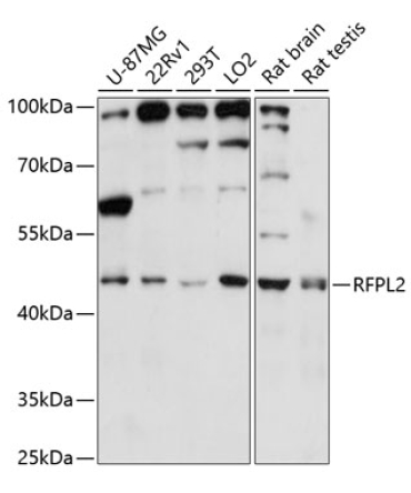 RFPL2 Rabbit Polyclonal Antibody