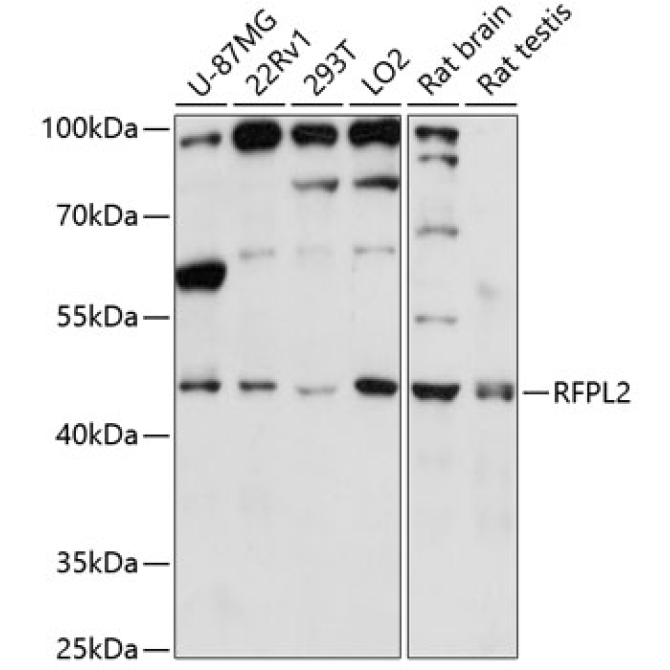 RFPL2 Rabbit Polyclonal Antibody