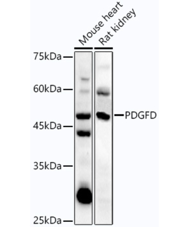PDGFD Rabbit Polyclonal Antibody