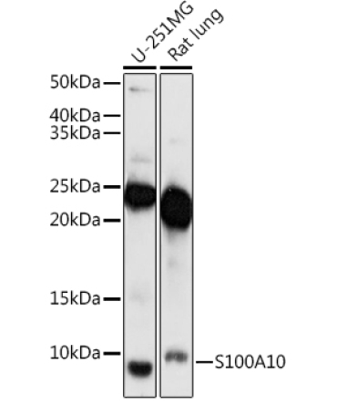 S100A10 Rabbit Polyclonal Antibody