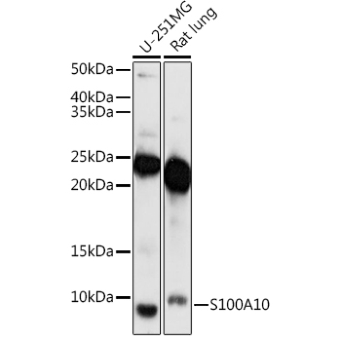 S100A10 Rabbit Polyclonal Antibody