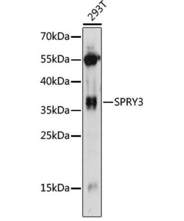 SPRY3 Rabbit Polyclonal Antibody