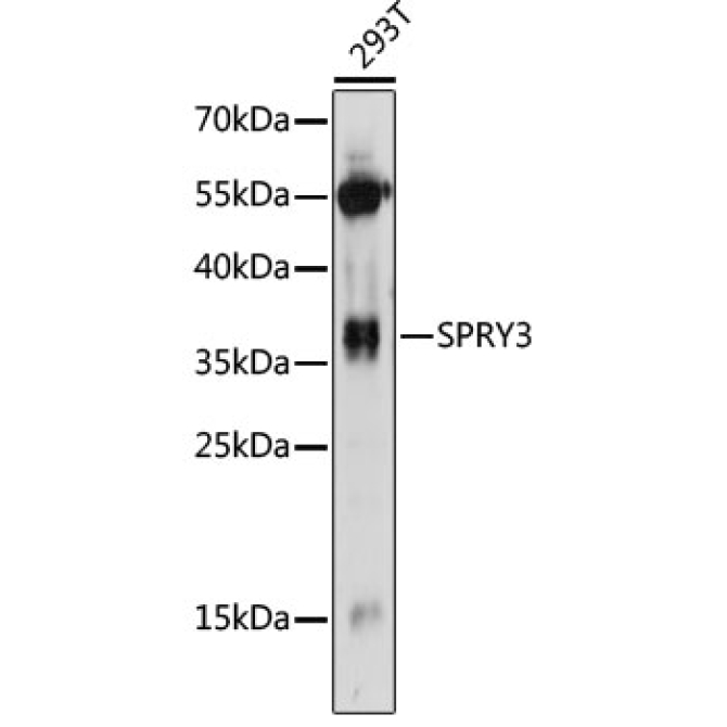 SPRY3 Rabbit Polyclonal Antibody