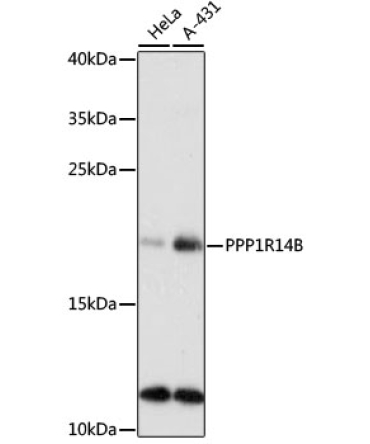 PPP1R14B Rabbit Polyclonal Antibody