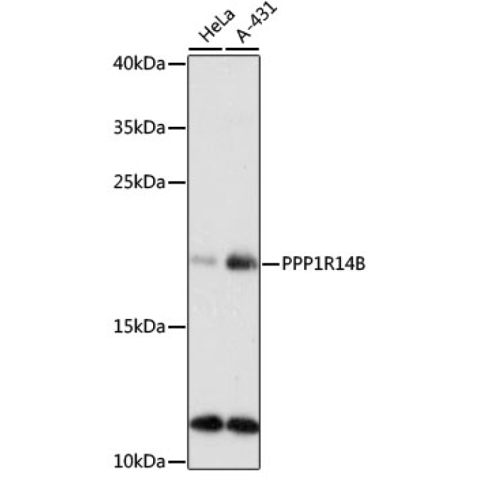 PPP1R14B Rabbit Polyclonal Antibody