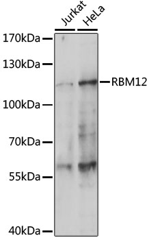 RBM12 Rabbit Polyclonal Antibody