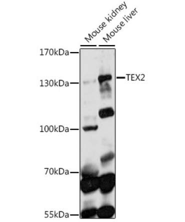 TEX2 Rabbit Polyclonal Antibody