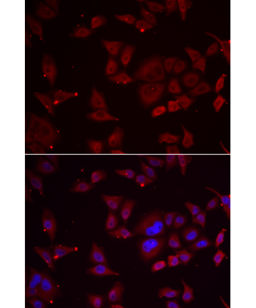 PFKFB3 Rabbit Polyclonal Antibody