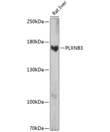 PLXNB3 Rabbit Polyclonal Antibody