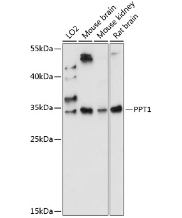 PPT1 Rabbit Polyclonal Antibody