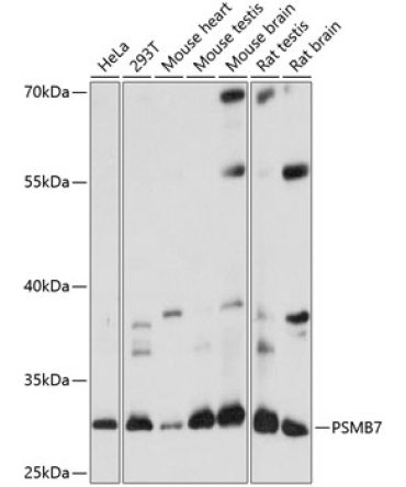 PSMB7 Rabbit Polyclonal Antibody