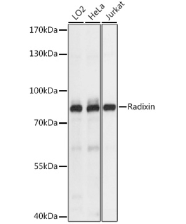 Radixin Rabbit Polyclonal Antibody