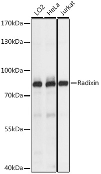 Radixin Rabbit Polyclonal Antibody