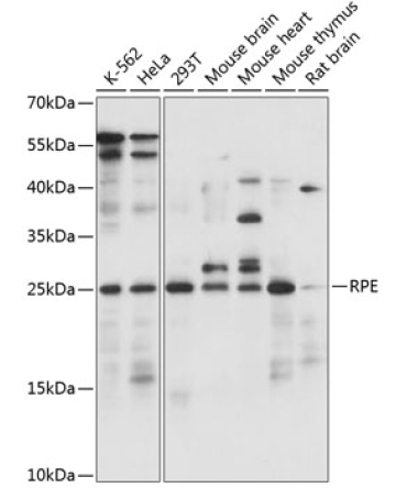 RPE Rabbit Polyclonal Antibody