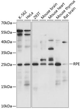 RPE Rabbit Polyclonal Antibody
