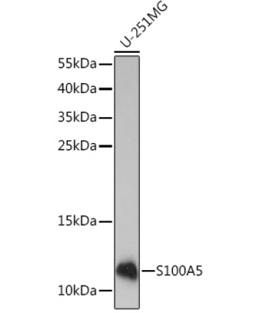 S100A5 Rabbit Polyclonal Antibody