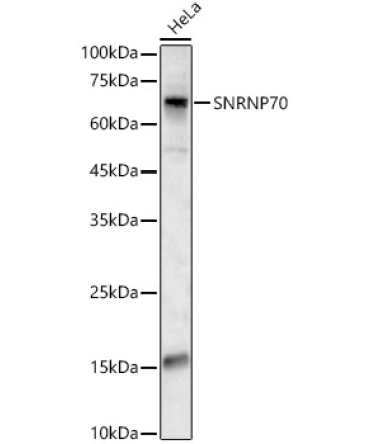 SNRNP70 Rabbit Polyclonal Antibody