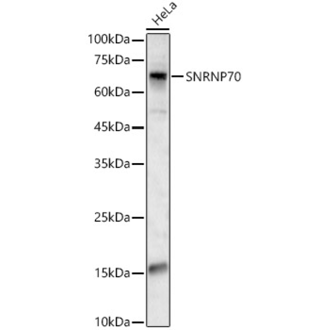SNRNP70 Rabbit Polyclonal Antibody