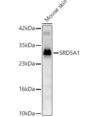 SRD5A1 Rabbit Polyclonal Antibody