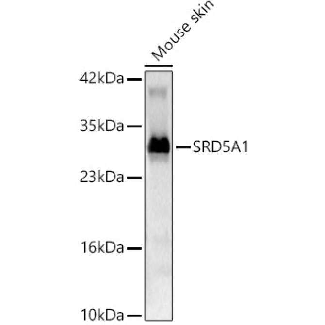 SRD5A1 Rabbit Polyclonal Antibody