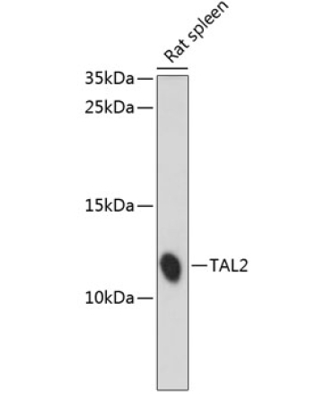 TAL2 Rabbit Polyclonal Antibody