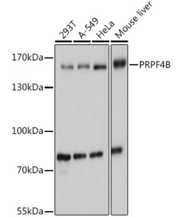 PRPF4B Rabbit Polyclonal Antibody