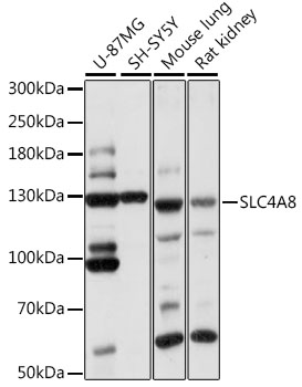 SLC4A8 Rabbit Polyclonal Antibody