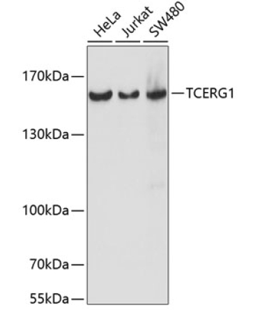 TCERG1 Rabbit Polyclonal Antibody