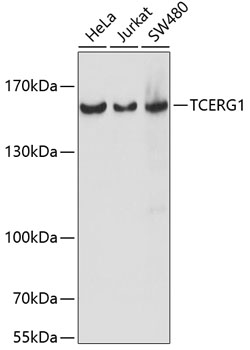 TCERG1 Rabbit Polyclonal Antibody