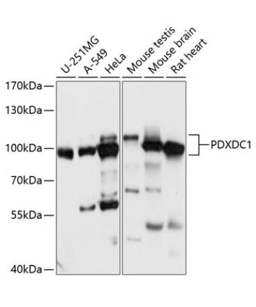 PDXDC1 Rabbit Polyclonal Antibody