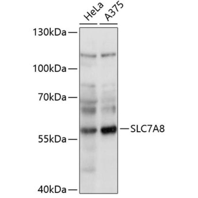 SLC7A8 Rabbit Polyclonal Antibody