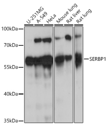 SERBP1 Rabbit Polyclonal Antibody