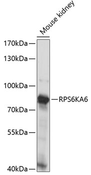 RPS6KA6 Rabbit Polyclonal Antibody