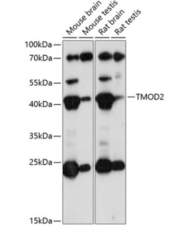 TMOD2 Rabbit Polyclonal Antibody
