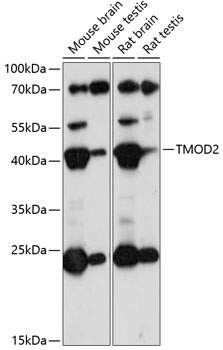 TMOD2 Rabbit Polyclonal Antibody