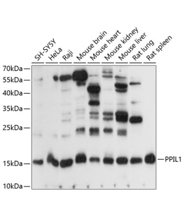 PPIL1 Rabbit Polyclonal Antibody